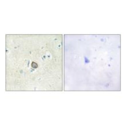 Immunohistochemistry - CELSR3 Antibody from Signalway Antibody (34198) - Antibodies.com