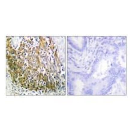 Immunohistochemistry - MMP-10 Antibody from Signalway Antibody (33435) - Antibodies.com