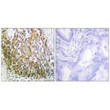 Immunohistochemistry - MMP-10 Antibody from Signalway Antibody (33435) - Antibodies.com