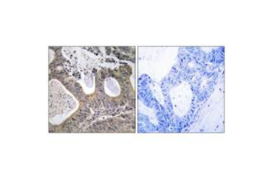Immunohistochemistry - STEA2 Antibody from Signalway Antibody (33979) - Antibodies.com