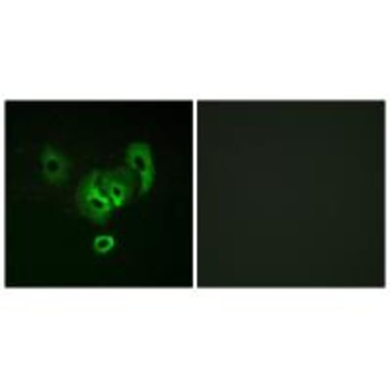 Immunofluorescence - STEA2 Antibody from Signalway Antibody (33979) - Antibodies.com