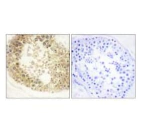 Immunohistochemistry - ECRG4 Antibody from Signalway Antibody (34059) - Antibodies.com