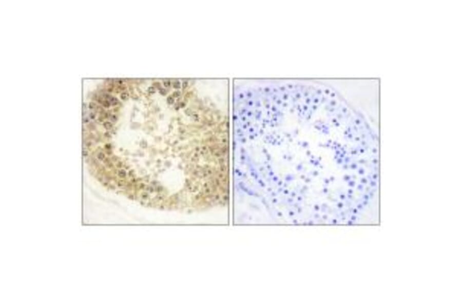 Immunohistochemistry - ECRG4 Antibody from Signalway Antibody (34059) - Antibodies.com