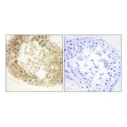 Immunohistochemistry - ECRG4 Antibody from Signalway Antibody (34059) - Antibodies.com