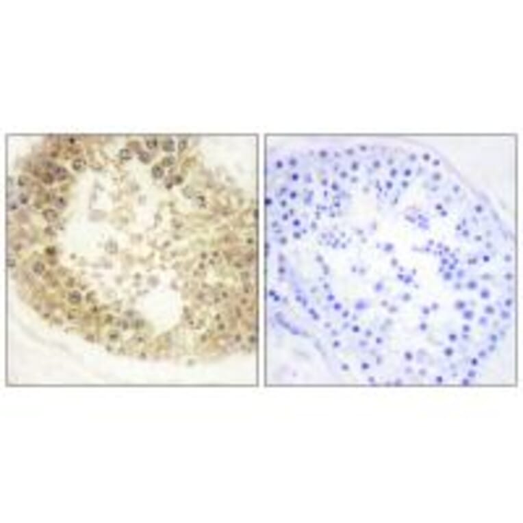 Immunohistochemistry - ECRG4 Antibody from Signalway Antibody (34059) - Antibodies.com