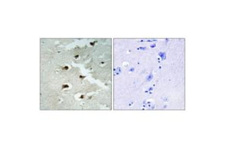 Immunohistochemistry - CDCA4 Antibody from Signalway Antibody (34193) - Antibodies.com