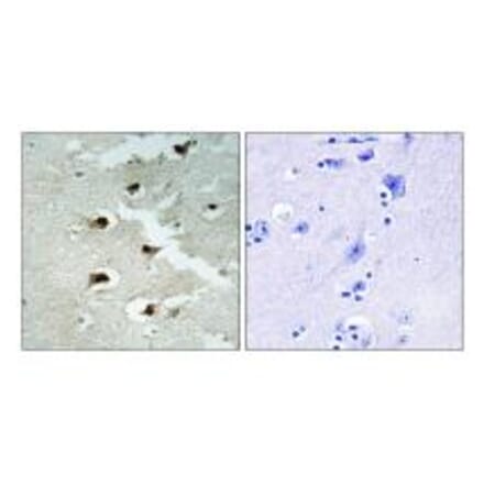 Immunohistochemistry - CDCA4 Antibody from Signalway Antibody (34193) - Antibodies.com