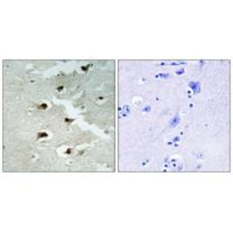 Immunohistochemistry - CDCA4 Antibody from Signalway Antibody (34193) - Antibodies.com