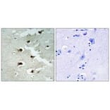 Immunohistochemistry - CDCA4 Antibody from Signalway Antibody (34193) - Antibodies.com