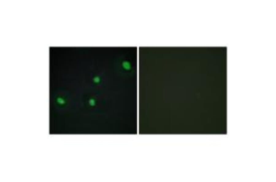 Immunofluorescence - CDCA4 Antibody from Signalway Antibody (34193) - Antibodies.com