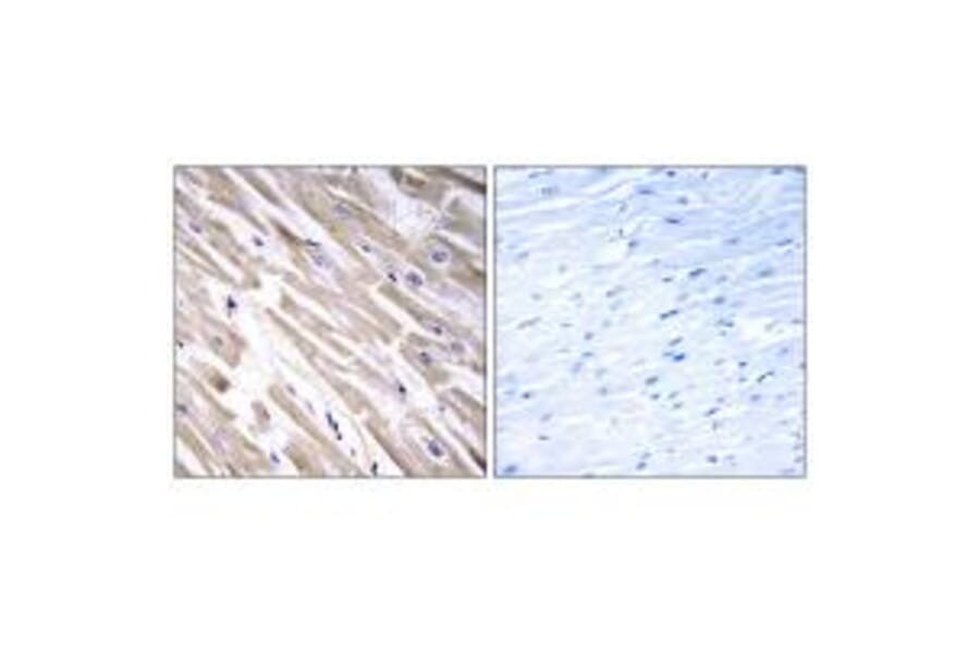 Immunohistochemistry - FGF18 Antibody from Signalway Antibody (34247) - Antibodies.com