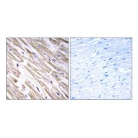 Immunohistochemistry - FGF18 Antibody from Signalway Antibody (34247) - Antibodies.com