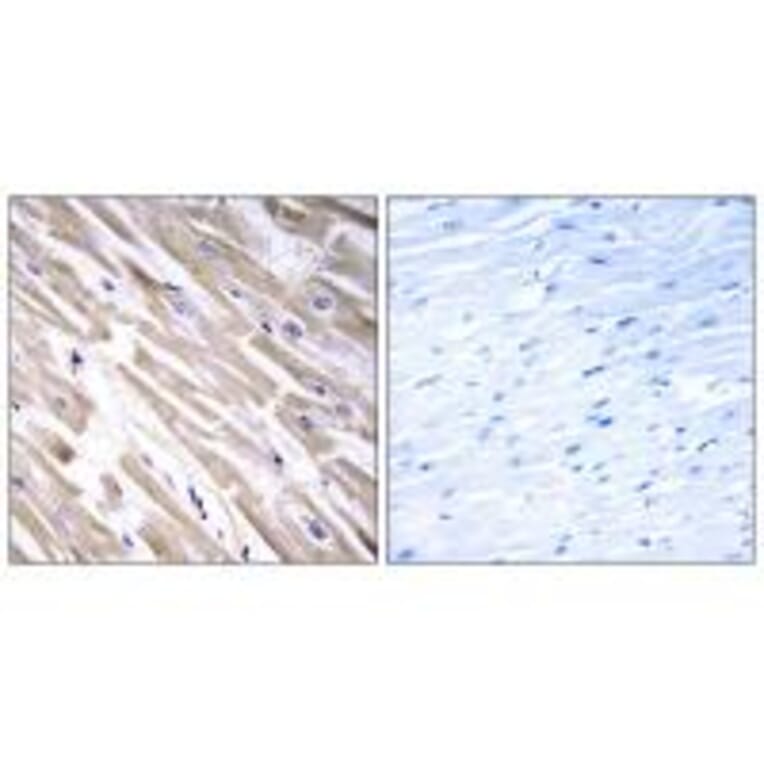 Immunohistochemistry - FGF18 Antibody from Signalway Antibody (34247) - Antibodies.com