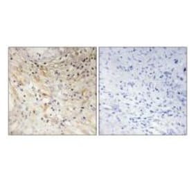 Immunohistochemistry - LAMB3 Antibody from Signalway Antibody (34278) - Antibodies.com