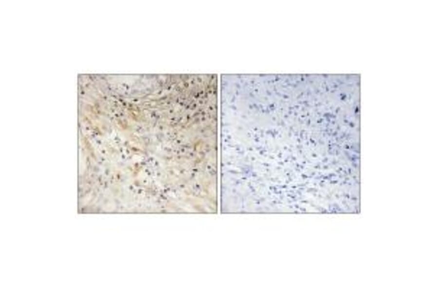 Immunohistochemistry - LAMB3 Antibody from Signalway Antibody (34278) - Antibodies.com