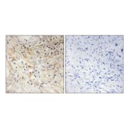Immunohistochemistry - LAMB3 Antibody from Signalway Antibody (34278) - Antibodies.com
