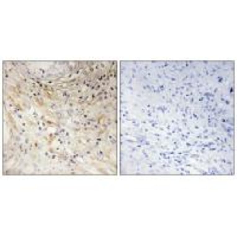 Immunohistochemistry - LAMB3 Antibody from Signalway Antibody (34278) - Antibodies.com