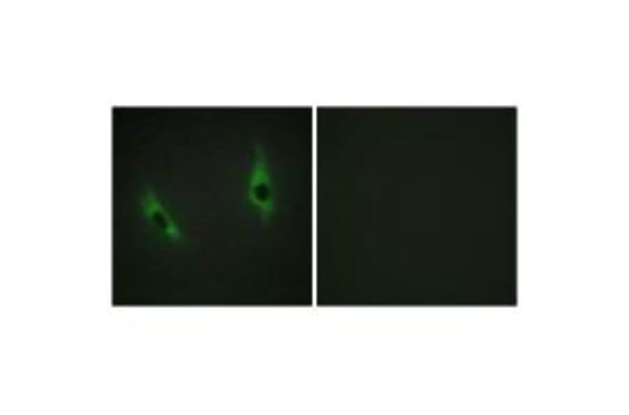 Immunofluorescence - LAMB3 Antibody from Signalway Antibody (34278) - Antibodies.com