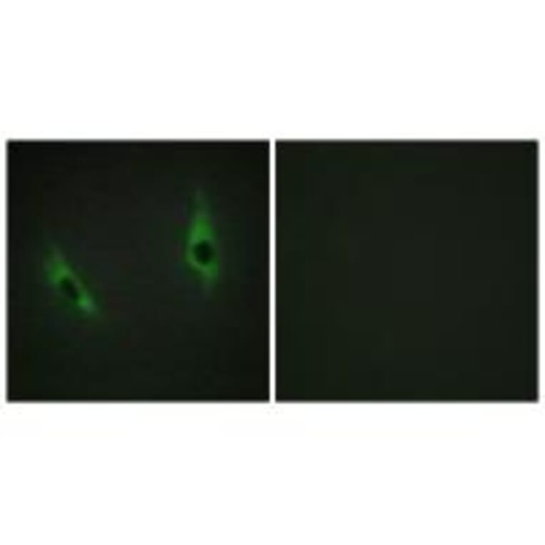 Immunofluorescence - LAMB3 Antibody from Signalway Antibody (34278) - Antibodies.com