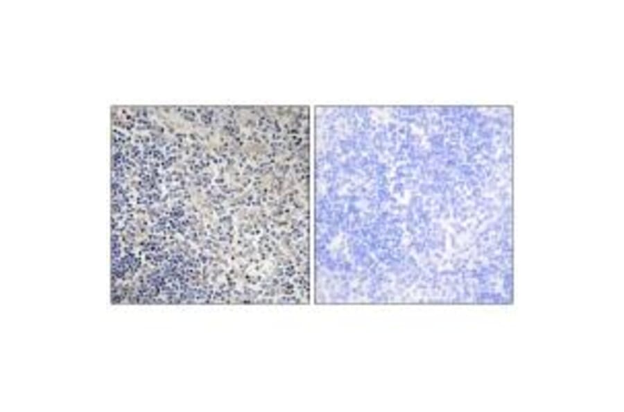 Immunohistochemistry - TPIP1 Antibody from Signalway Antibody (34300) - Antibodies.com