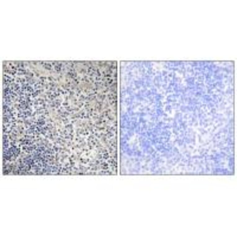 Immunohistochemistry - TPIP1 Antibody from Signalway Antibody (34300) - Antibodies.com