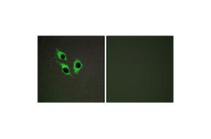 Immunofluorescence - TM16J Antibody from Signalway Antibody (33552) - Antibodies.com