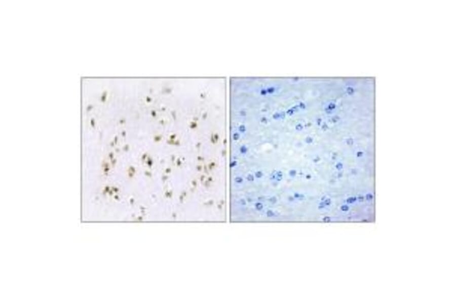 Immunohistochemistry - HMG17 Antibody from Signalway Antibody (33651) - Antibodies.com
