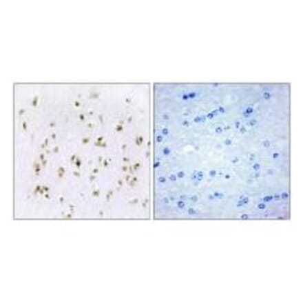 Immunohistochemistry - HMG17 Antibody from Signalway Antibody (33651) - Antibodies.com