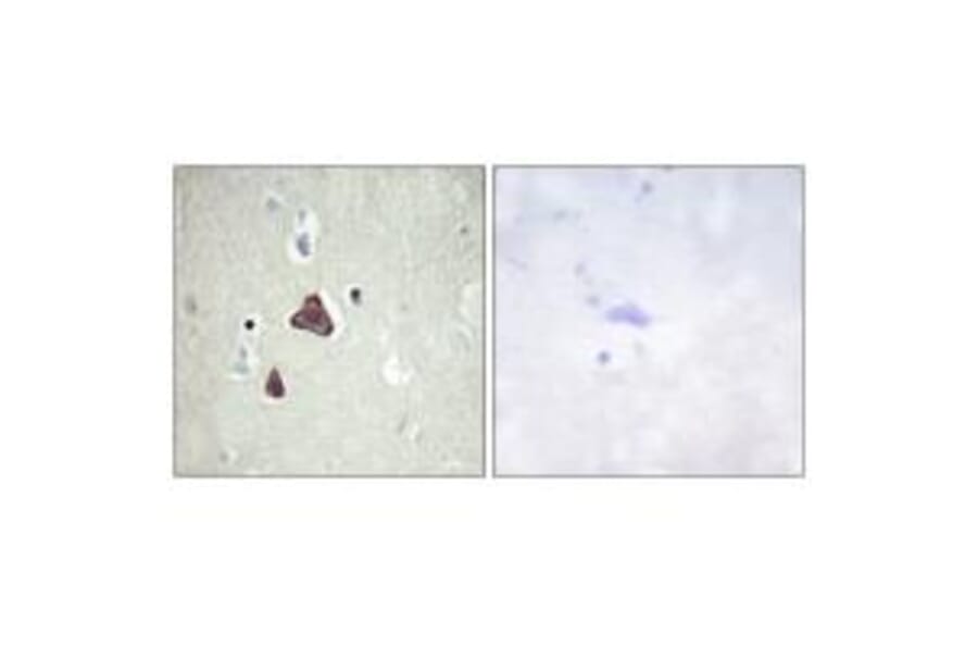 Immunohistochemistry - ADCY8 Antibody from Signalway Antibody (34163) - Antibodies.com
