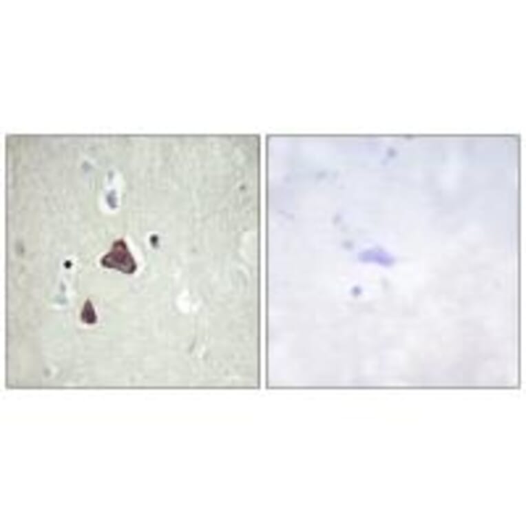Immunohistochemistry - ADCY8 Antibody from Signalway Antibody (34163) - Antibodies.com