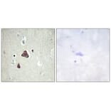 Immunohistochemistry - ADCY8 Antibody from Signalway Antibody (34163) - Antibodies.com