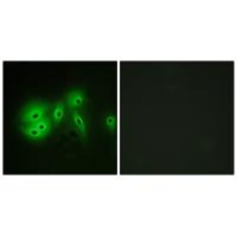 Immunofluorescence - ADCY8 Antibody from Signalway Antibody (34163) - Antibodies.com