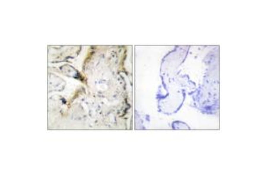 Immunohistochemistry - LAMA2 Antibody from Signalway Antibody (34273) - Antibodies.com