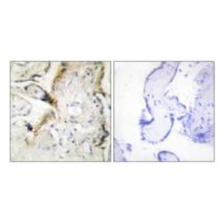 Immunohistochemistry - LAMA2 Antibody from Signalway Antibody (34273) - Antibodies.com