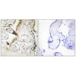 Immunohistochemistry - LAMA2 Antibody from Signalway Antibody (34273) - Antibodies.com