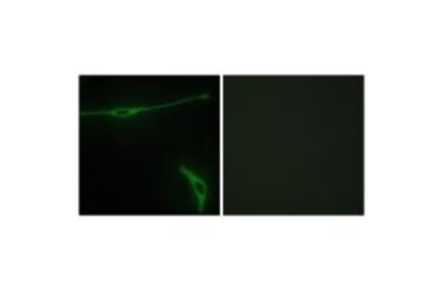Immunofluorescence - LAMA2 Antibody from Signalway Antibody (34273) - Antibodies.com