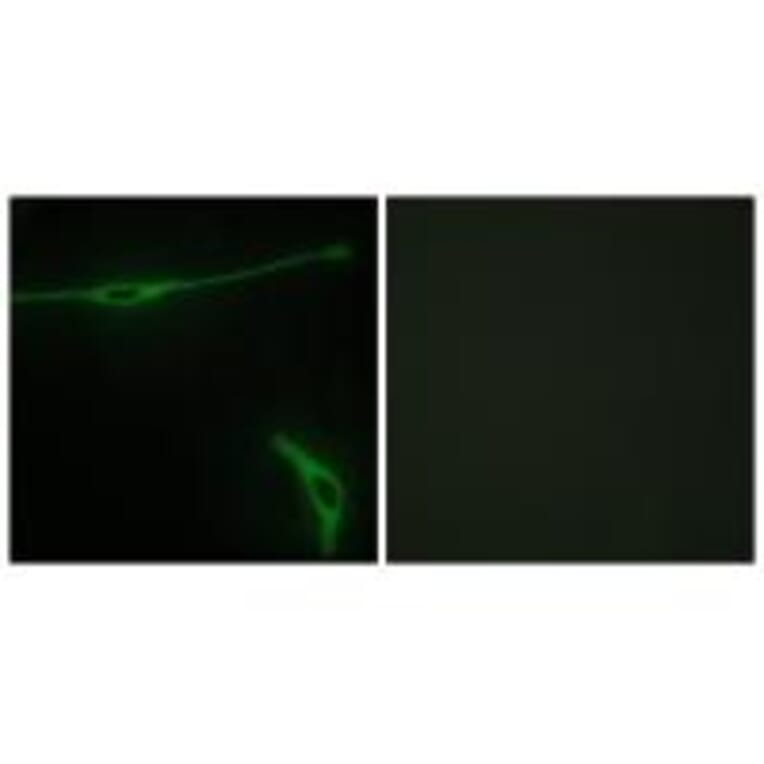 Immunofluorescence - LAMA2 Antibody from Signalway Antibody (34273) - Antibodies.com