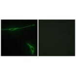 Immunofluorescence - LAMA2 Antibody from Signalway Antibody (34273) - Antibodies.com