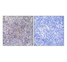 Immunohistochemistry - XRCC3 Antibody from Signalway Antibody (34301) - Antibodies.com