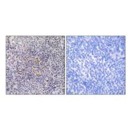 Immunohistochemistry - XRCC3 Antibody from Signalway Antibody (34301) - Antibodies.com
