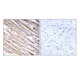 Immunohistochemistry - RPL3L Antibody from Signalway Antibody (34361) - Antibodies.com