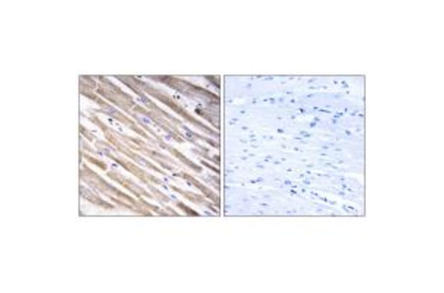 Immunohistochemistry - RPL3L Antibody from Signalway Antibody (34361) - Antibodies.com