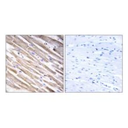 Immunohistochemistry - RPL3L Antibody from Signalway Antibody (34361) - Antibodies.com