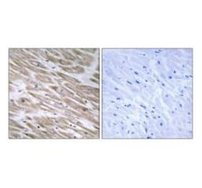 Immunohistochemistry - KANK2 Antibody from Signalway Antibody (34424) - Antibodies.com