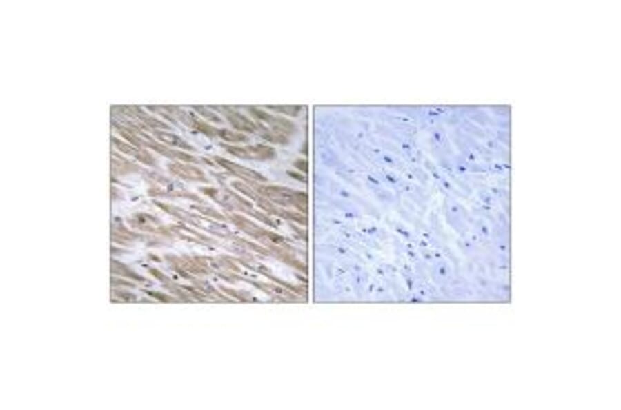 Immunohistochemistry - KANK2 Antibody from Signalway Antibody (34424) - Antibodies.com