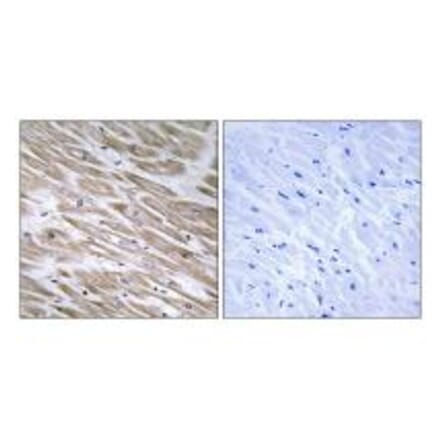 Immunohistochemistry - KANK2 Antibody from Signalway Antibody (34424) - Antibodies.com