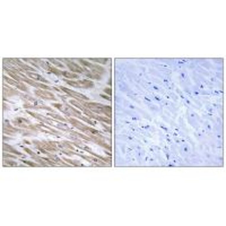 Immunohistochemistry - KANK2 Antibody from Signalway Antibody (34424) - Antibodies.com