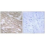 Immunohistochemistry - KANK2 Antibody from Signalway Antibody (34424) - Antibodies.com