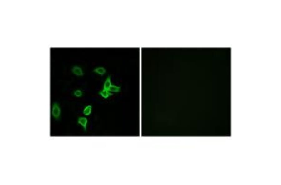 Immunofluorescence - KANK2 Antibody from Signalway Antibody (34424) - Antibodies.com