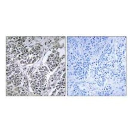 Immunohistochemistry - ATP5D Antibody from Signalway Antibody (34447) - Antibodies.com